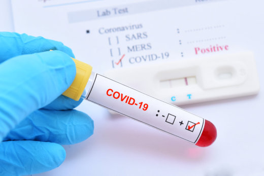 What to Do If You Think You May Have COVID-19